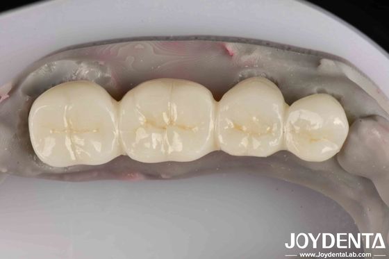 Sản phẩm trắng tuyệt vời Zirconia đầy đủ với khả năng chống ăn mòn cao