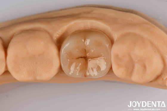 Ứng dụng chính xác cao Zirconia đầy đủ với khả năng chống sốc nhiệt cao