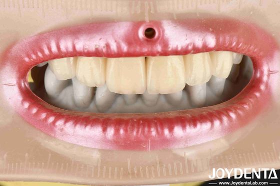 Lớp Zirconia thẩm mỹ cao Tương thích sinh học tuyệt vời Nhiệt độ ngâm 1350-1450 °C Đối với vật liệu tiên tiến