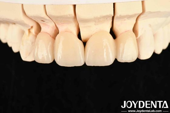 Giao dẫn nhiệt 3 W / mK Zirconia lớp xuyên suốt cao cho hiệu suất đặc biệt