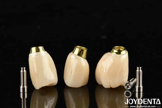 Độ bền cao kết thúc màu trắng cấy ghép vương miện và cầu với phù hợp chính xác