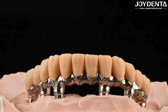 Nhựa vàng răng tạm thời xử lý bề mặt mịn mịn chính xác và ổn định