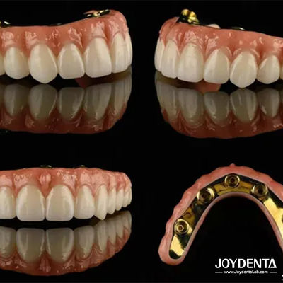 Ti Bar Zirconia Hybrid Implant Bridges High Translucency cho răng giả