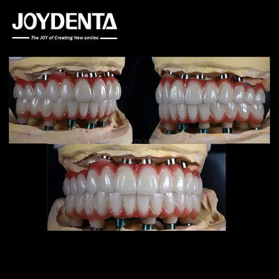 10mm Titanium đa răng cấy ghép bề mặt thô để phục hồi răng