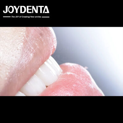 Long Lasting Dental Composite Veneer Tốt Biocompatibility Không Giả Giảm veneers sứ