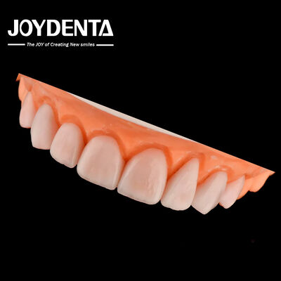 IPS gốm được làm theo yêu cầu Emax veneers phục hồi răng chống vỡ