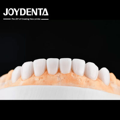 Enhance Case Acceptance & Patient Communication with Our Diagnostic Wax-Up Service