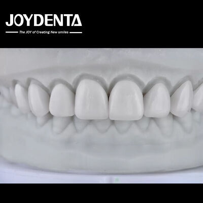 Visualize the Result, Secure the Case: Our Diagnostic Wax-Up Service